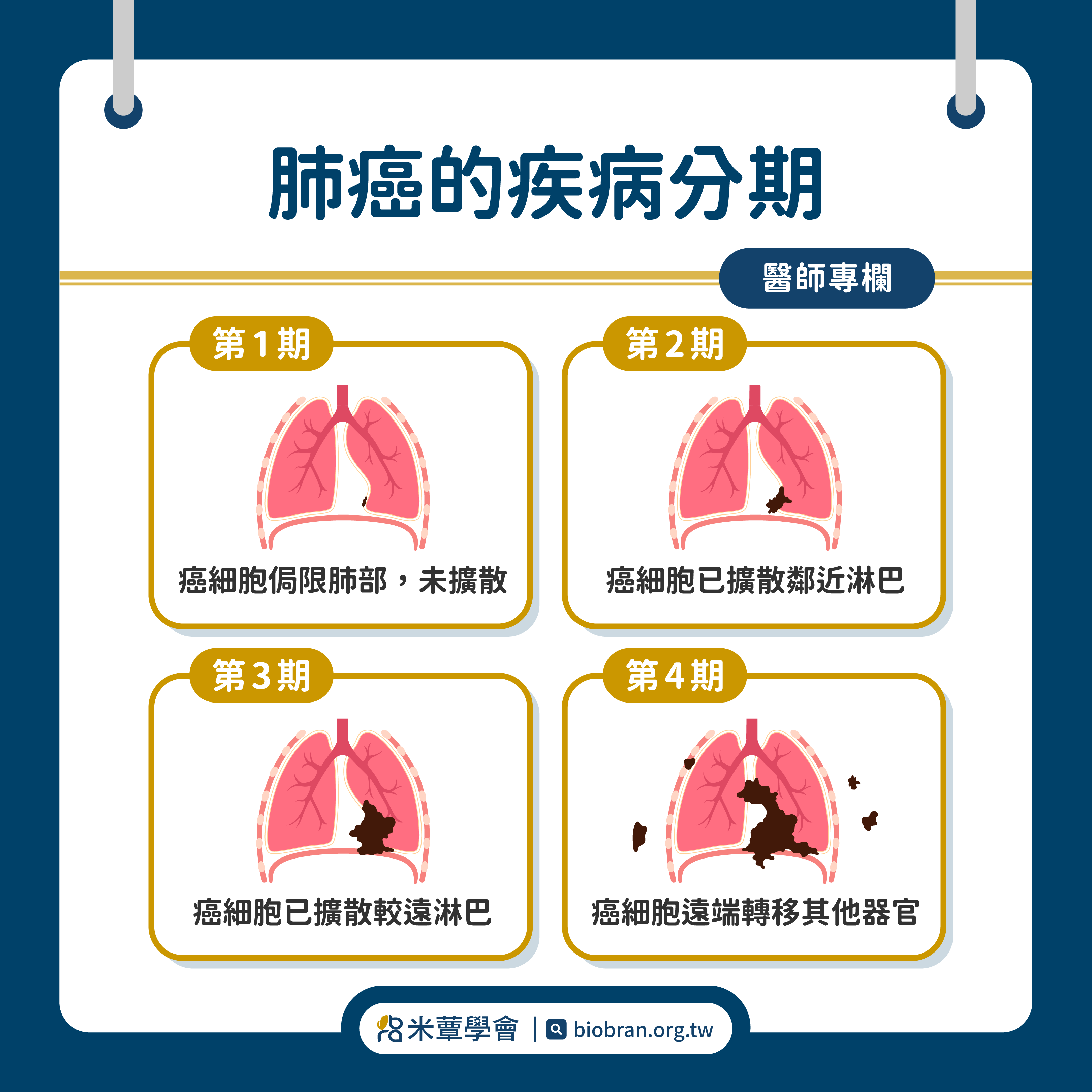 劉杜鎮醫師｜PM2.5吸多會得肺癌 破解肺的迷思&篩檢關鍵-3
