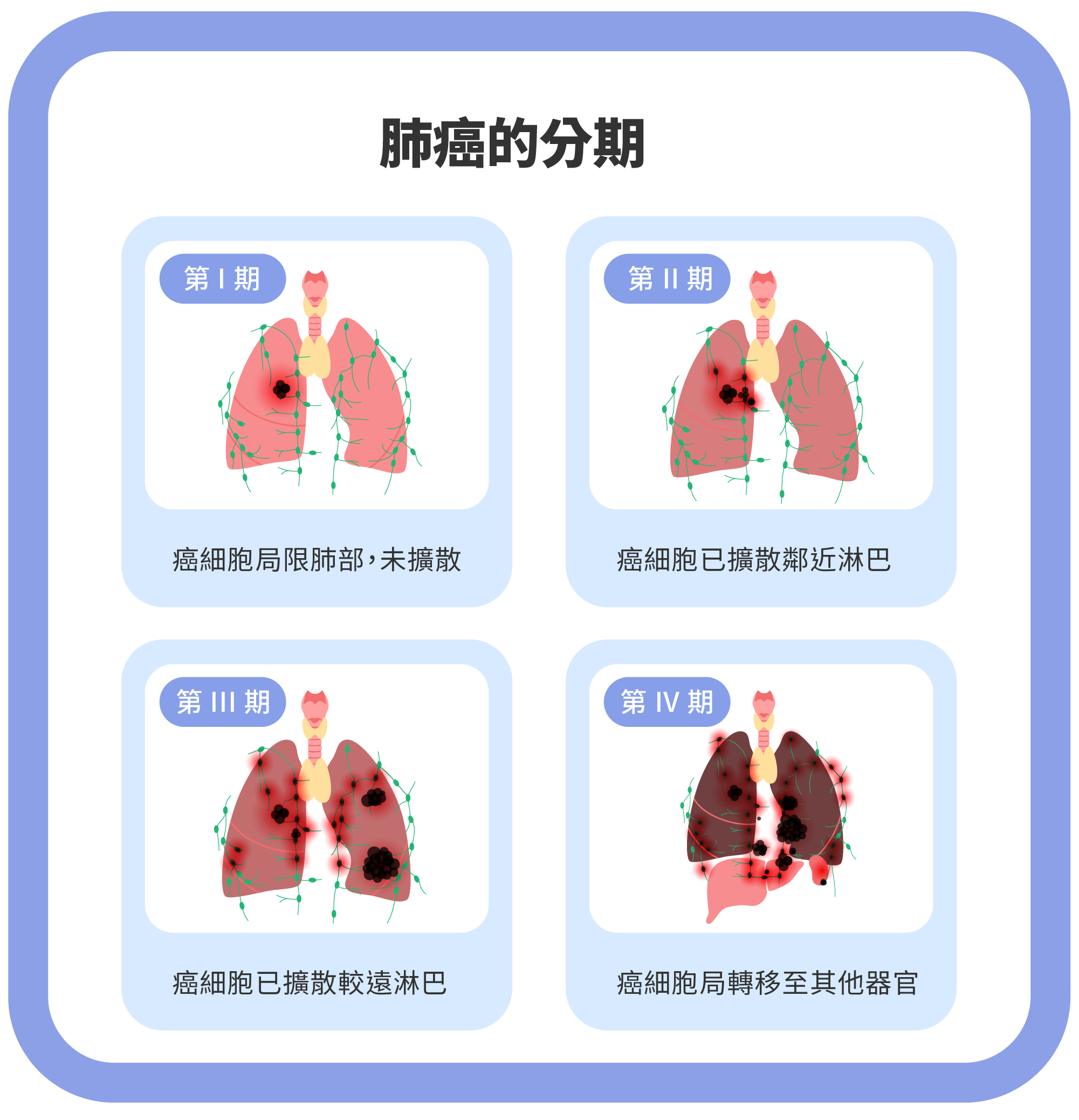 肺癌早期症狀不明顯?2025 年必知的 5 大警訊與篩檢指南-3