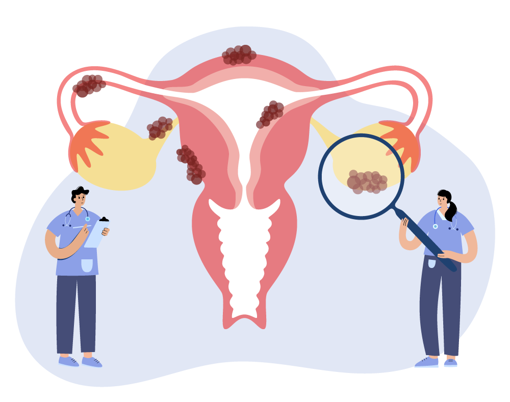 婦科諮詢室-子宮內膜跑錯棚,變成巧克力囊腫?!