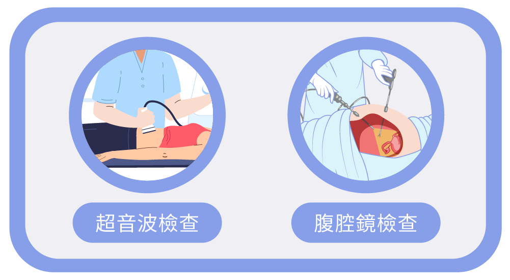 巧克力囊腫的常見的診斷方式 :
