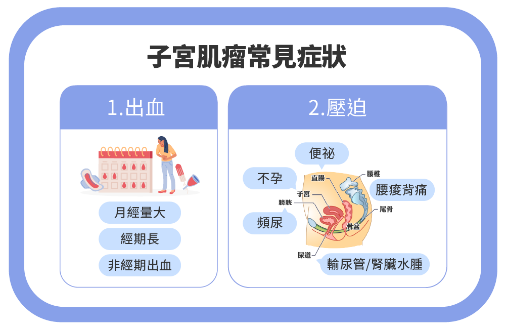 子 宮肌瘤常見症狀